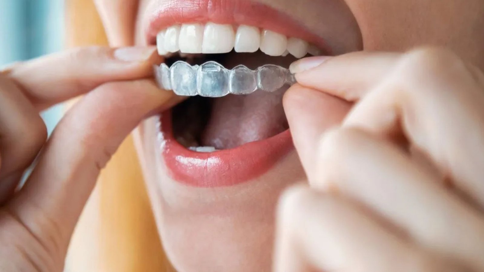 Untitled design 2025 12 03T142530.054